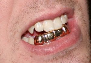 Cigar Teeth